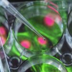 Allogeneic Stem Cell